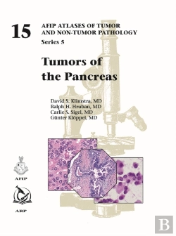 Bertrand.pt - Tumors Of The Pancreas
