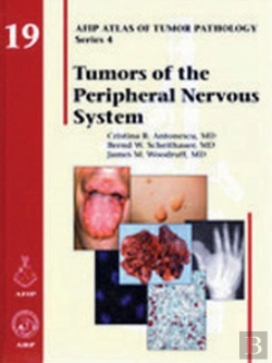 Bertrand.pt - Tumors Of The Peripheral Nervous System