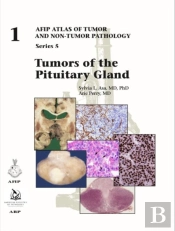 Tumors Of The Pituitary Gland