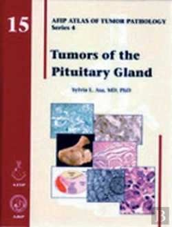 Bertrand.pt - Tumors Of The Pituitary Gland