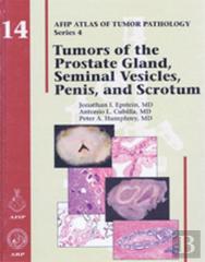 Tumors Of The Prostate Gland, Seminal Vesicles, Penis, And Scrotum