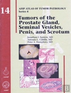 Bertrand.pt - Tumors Of The Prostate Gland, Seminal Vesicles, Penis, And Scrotum