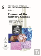 Tumors Of The Salivary Glands
