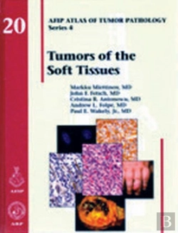 Bertrand.pt - Tumors Of The Soft Tissues
