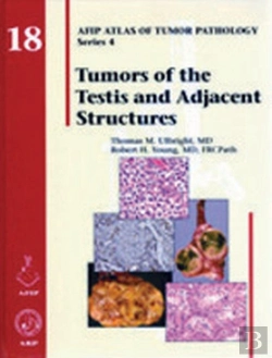 Bertrand.pt - Tumors Of The Testis And Adjacent Structures