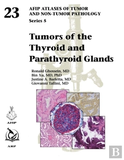 Bertrand.pt - Tumors Of The Thyroid And Parathyroid Glands
