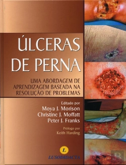 Bertrand.pt - Úlceras de Perna