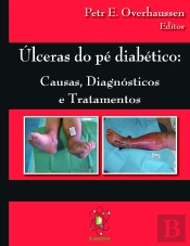 Úlceras do Pé Diabético