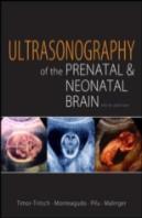 Ultrasonography Of The Prenatal And Neonatal Brain