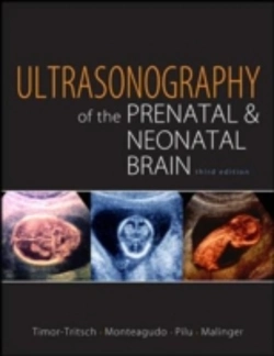 Bertrand.pt - Ultrasonography Of The Prenatal And Neonatal Brain