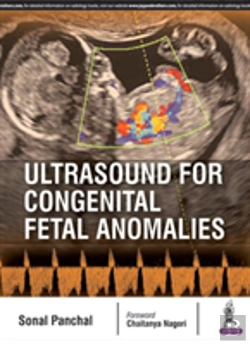 Bertrand.pt - Ultrasound For Congenital Fetal Anomalies