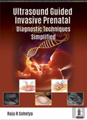 Ultrasound Guided Invasive Prenatal Diagnostic Techniques Simplified
