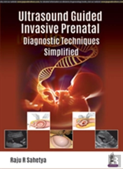 Bertrand.pt - Ultrasound Guided Invasive Prenatal Diagnostic Techniques Simplified