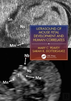 Bertrand.pt - Ultrasound Of Mouse Fetal Development And Human Correlates