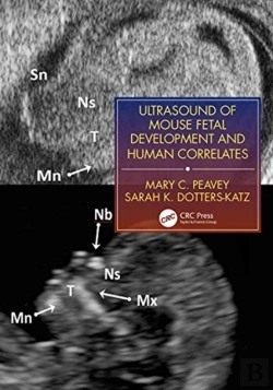 Bertrand.pt - Ultrasound Of Mouse Fetal Development And Human Correlates