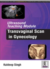 Ultrasound Teaching Module: Transvaginal Scan In Gynecology