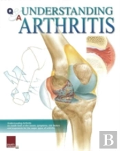 Understanding Arthritis Flip Chart