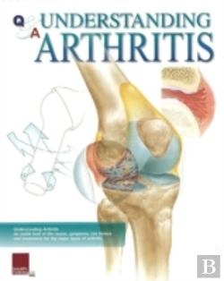 Bertrand.pt - Understanding Arthritis Flip Chart