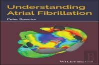 Understanding Atrial Fibrillation