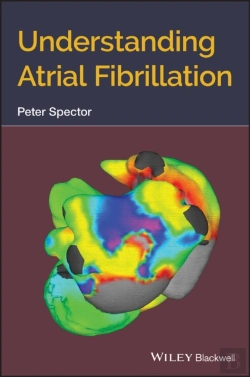 Bertrand.pt - Understanding Atrial Fibrillation