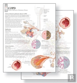 Bertrand.pt - Understanding Copd Study Set Replacement Pads