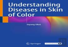 Understanding Diseases In Skin Of Color