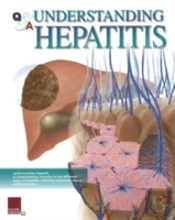 Understanding Hepatitis Flip Chart