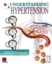 Understanding Hypertension Flip Chart