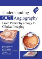 Understanding Oct Angiography