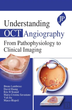 Bertrand.pt - Understanding Oct Angiography