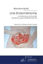 Une Endometriovie, Une Femme Sur Dix Atteinte ; Deuxieme Cause D'Infertilite Feminine