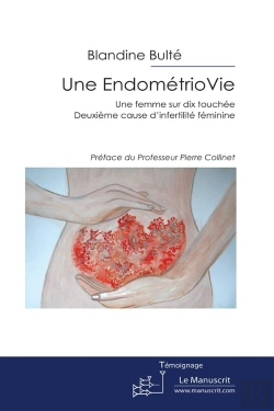 Bertrand.pt - Une Endometriovie, Une Femme Sur Dix Atteinte ; Deuxieme Cause D'Infertilite Feminine