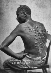 Universally Despised  Is My Skin The Si