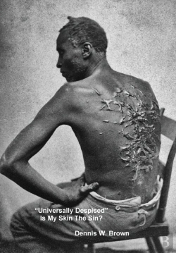 Bertrand.pt - Universally Despised  Is My Skin The Si