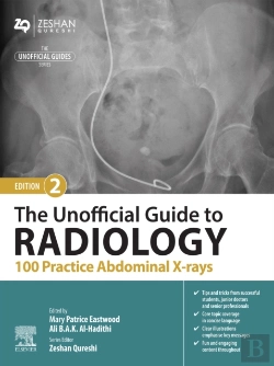 Bertrand.pt - Unofficial Guide To Radiology: 100 Practice Abdominal X-Rays