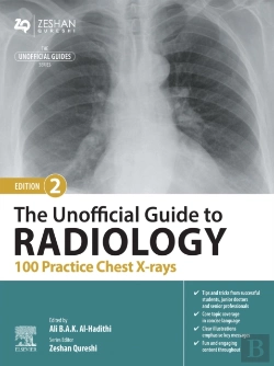 Bertrand.pt - Unofficial Guide To Radiology: 100 Practice Chest X-Rays - E-Book