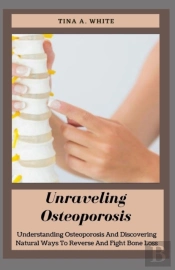 Unraveling Osteoporosis