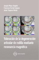 Uso De Antifibrinoliticos Para La Reduccion De Perdida Sanguinea En Cirugia Ortopedica Mayor