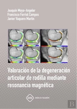 Bertrand.pt - Uso De Antifibrinoliticos Para La Reduccion De Perdida Sanguinea En Cirugia Ortopedica Mayor