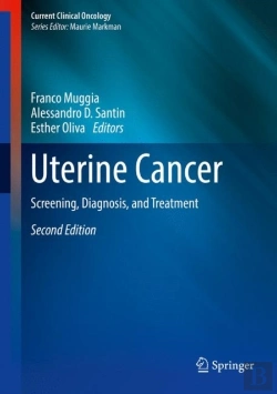 Bertrand.pt - Uterine Cancer