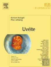 Uvéite