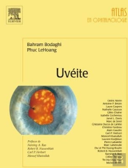 Bertrand.pt - Uvéite
