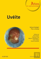 Uvéites (2e Édition)
