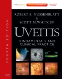 Bertrand.pt - Uveitis