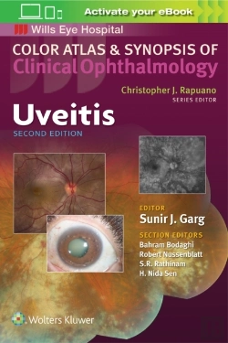 Bertrand.pt - Uveitis