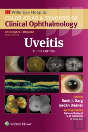 Uveitis