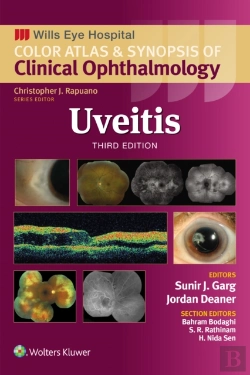 Bertrand.pt - Uveitis