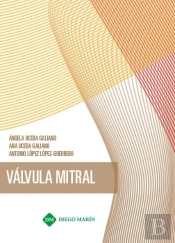 Valvula Mitral