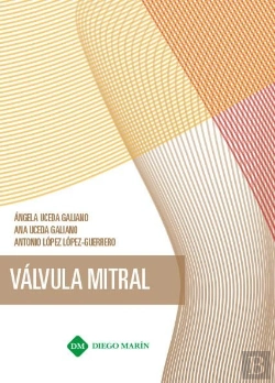 Bertrand.pt - Valvula Mitral