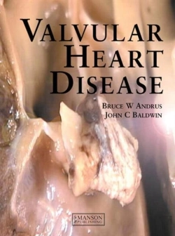Bertrand.pt - Valvular Heart Disease